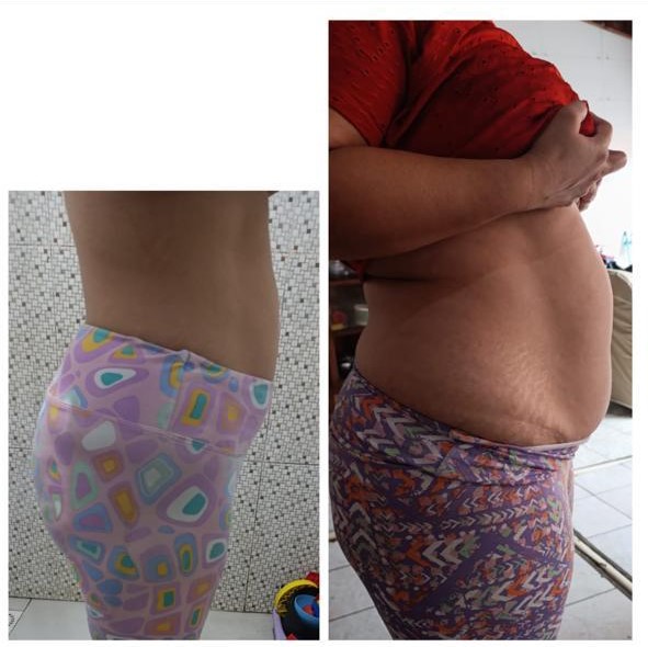 Antes e depois de perfil de participante do DANI-SE GORDURAS
